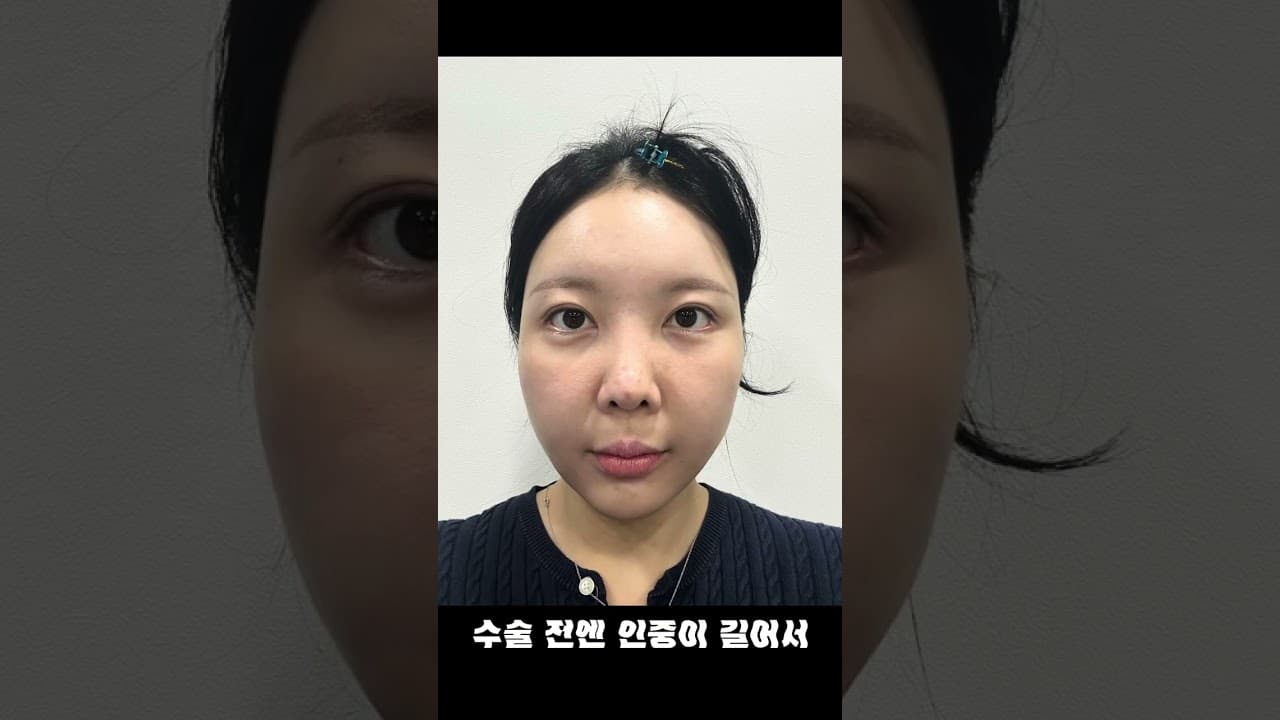 이거 하고 나서 10살은 어려 보인대요 🤭