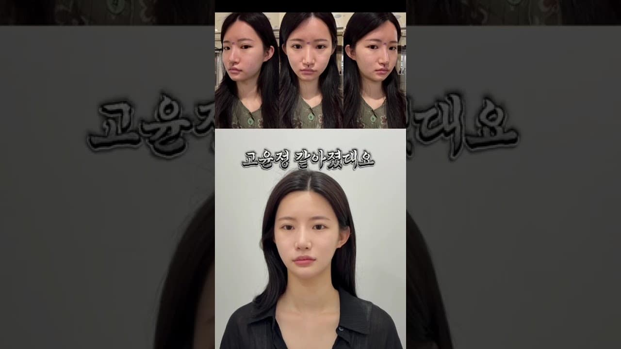 뭐라구요? 저 고윤정 닮았다구요? #코수술 #리스펙성형외과