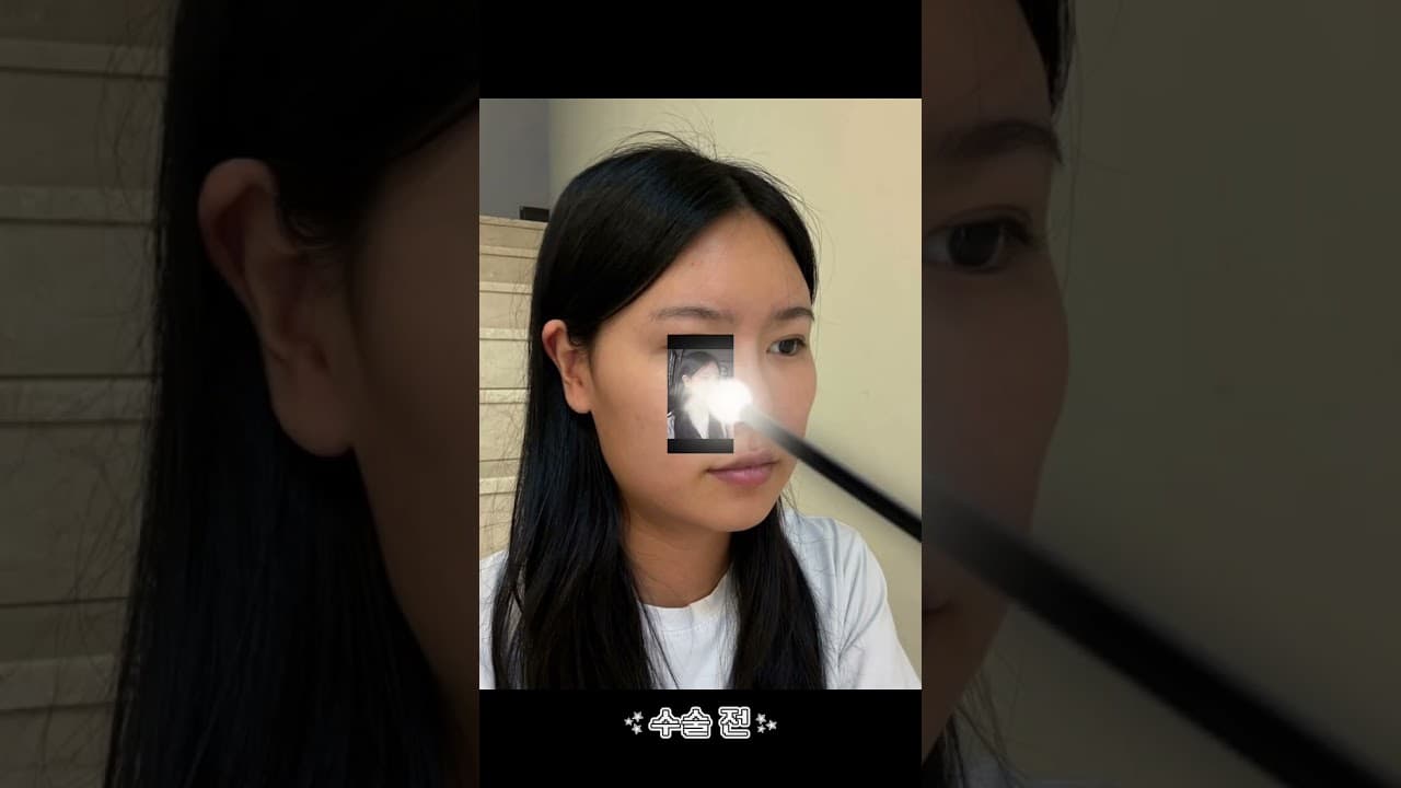 햄스터같았던 볼 이제 안녕👋🏻